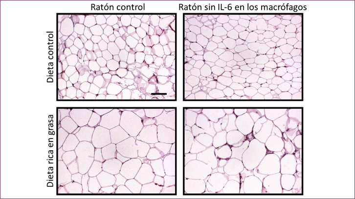 Com la interleucina 6 regula la inflamació del teixit adipós
